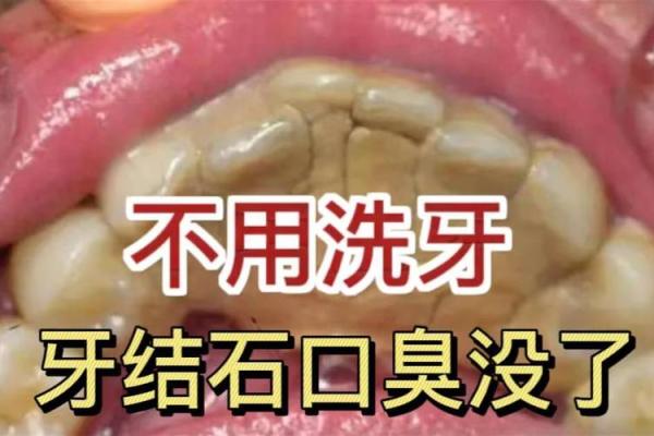 如何改善口臭问题，从牙齿做起