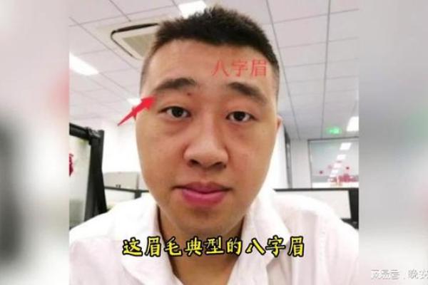 如何有效改善眉心八字纹的出现原因与解决方法