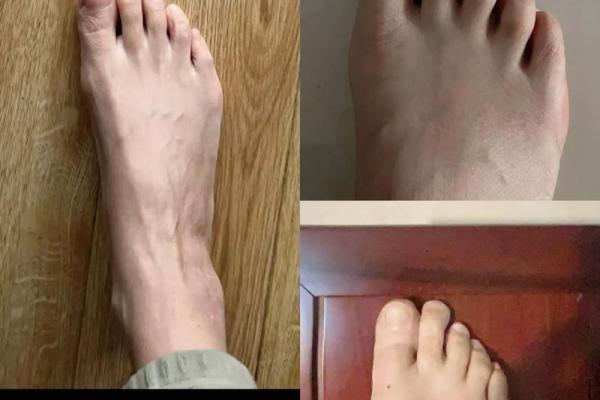 探索富贵命女的脚型特征，改变命运的第一步