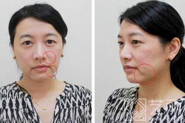嘴角八字纹揭示了什么样的人生轨迹？揭秘面相中的重要线索