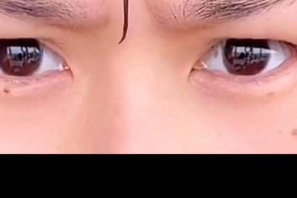 脸部八字纹不再烦恼，快速消除的方法大公开